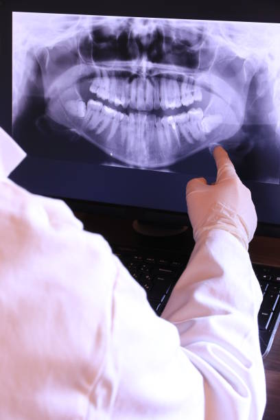 Best Urgent Care for Lost Fillings or Crowns in St David, AZ